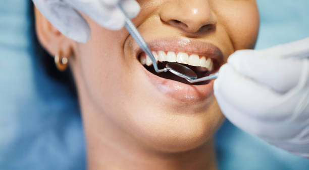 Best Emergency Dental Surgery in Fate, TX