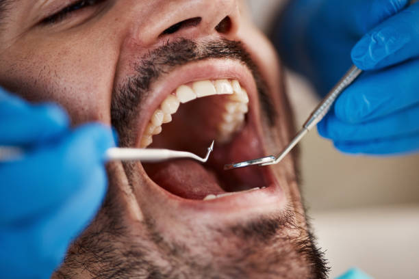 Best Emergency Dental Care for Trauma or Injury in Fate, TX